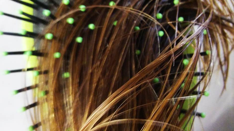  Opadanje kose usled stresa: Šta treba da znate 