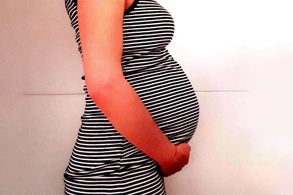  Neobične "nuspojave" u trudnoći 