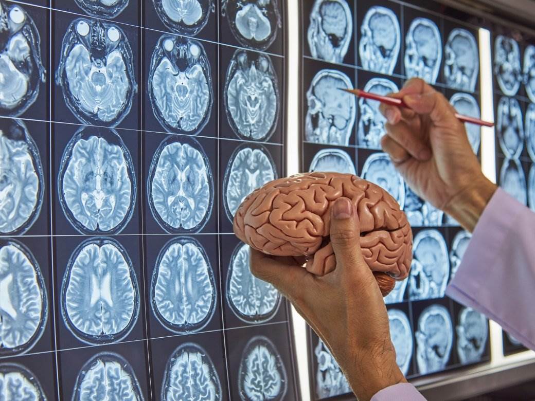  Ruski stručnjaci: Korona virus može da izazove oštećenje mozga? 