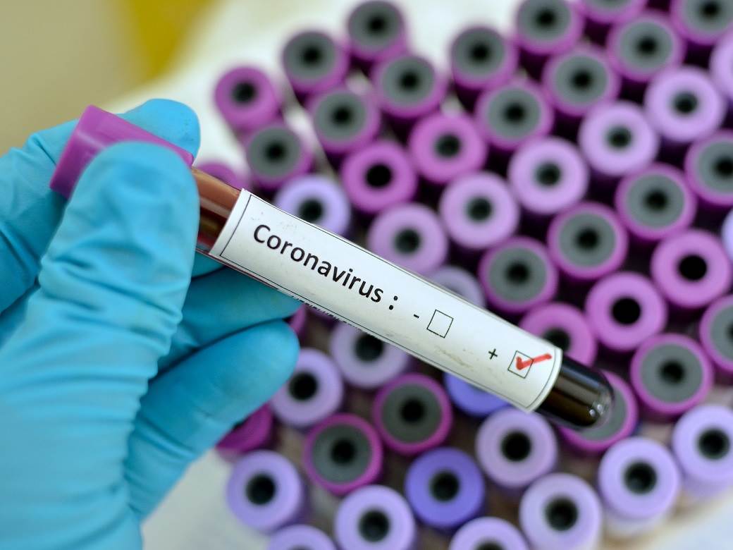  Riječ STRUČNJAKA: Da li možemo da budemo imuni na koronavirus? 