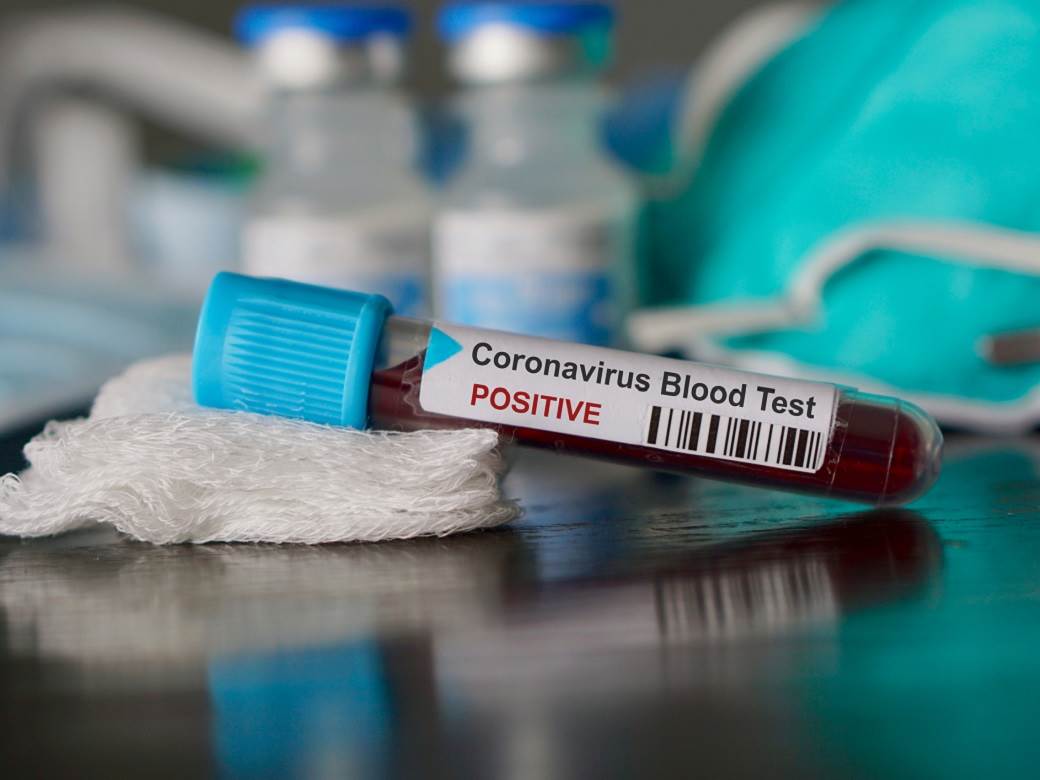  Smanjen broj novozaraženih koronavirusom 