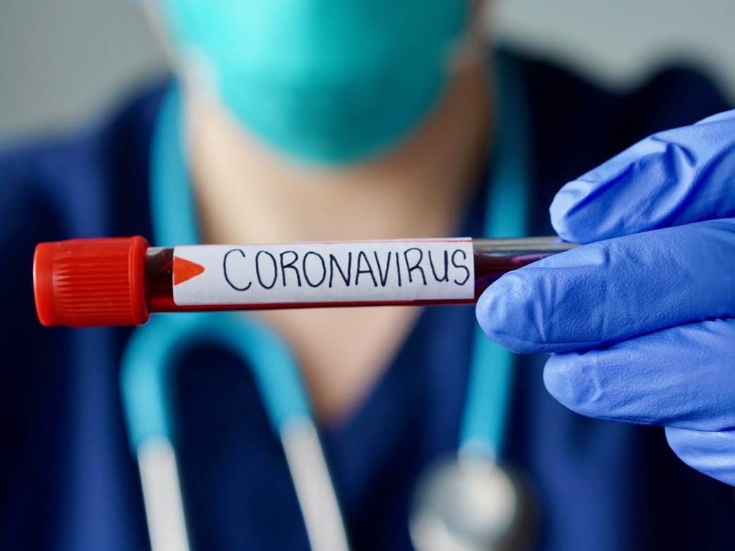 Hrvatska: Potvrđeno još 29 slučajeva korona virusa 