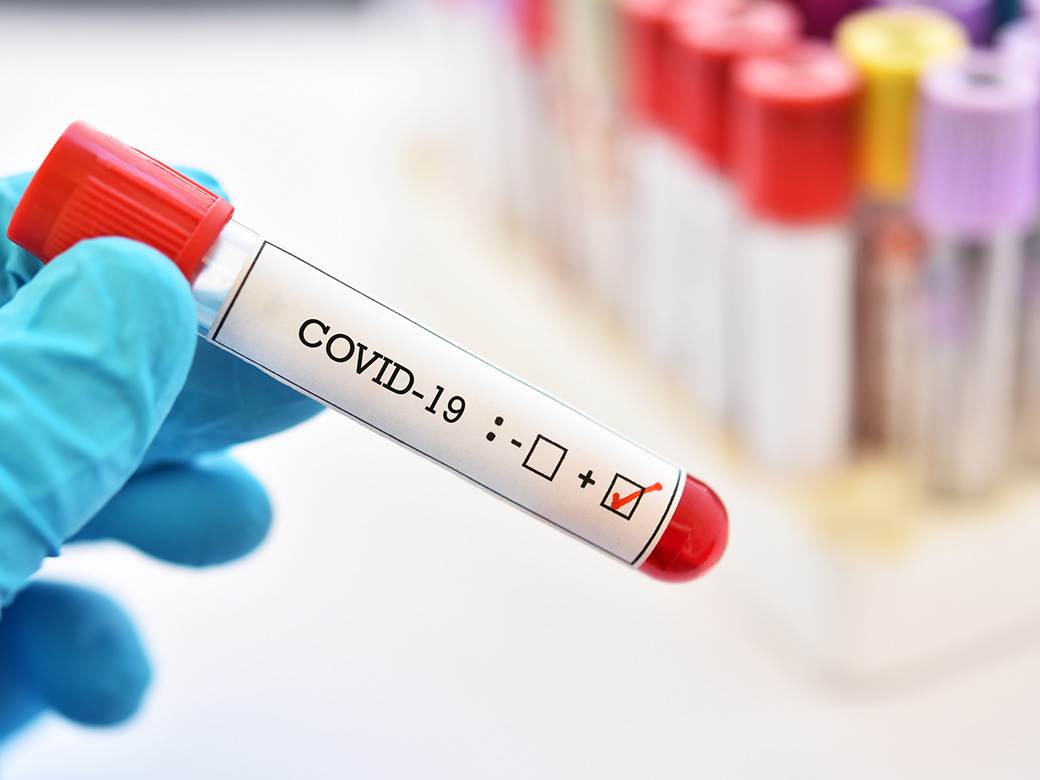  Jedan novi slučaj infekcije koronavirusom 