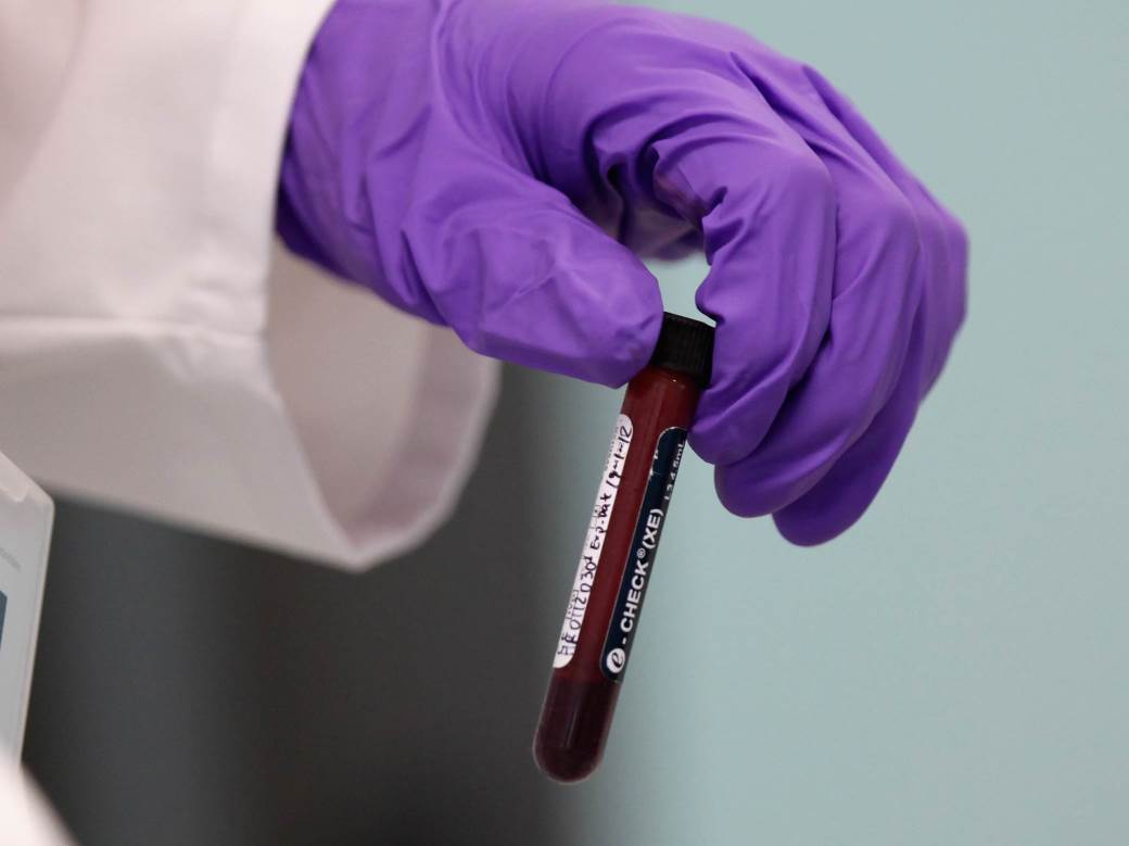  Lekari u čudu - kako 85% "lažno pozitivnih" na koronu? 