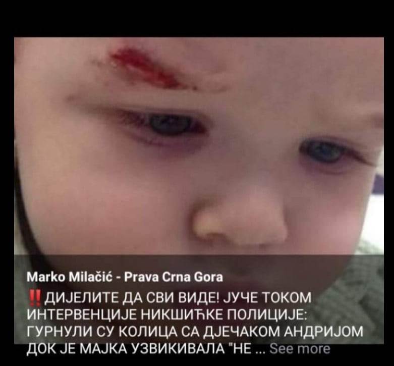  Ružno! Medojević i Milačić zloupotrijebili sliku djeteta sa interneta! 