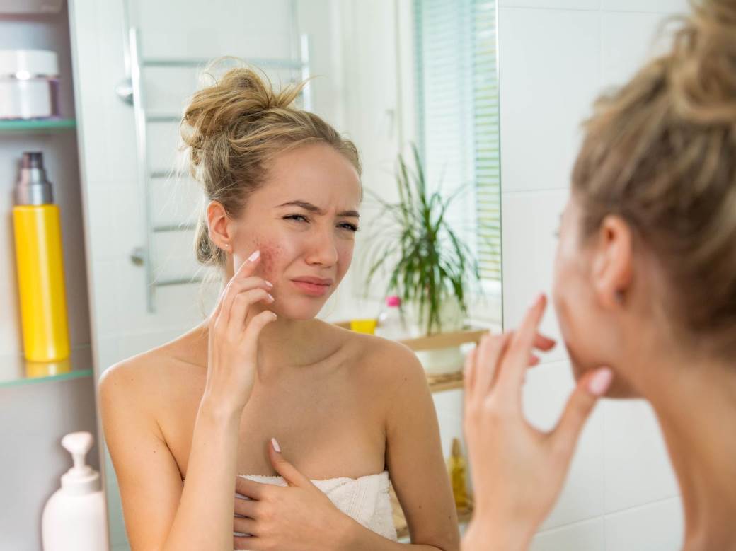  Kako da izbegnete iritaciju kože ako nosite zaštitnu masku 