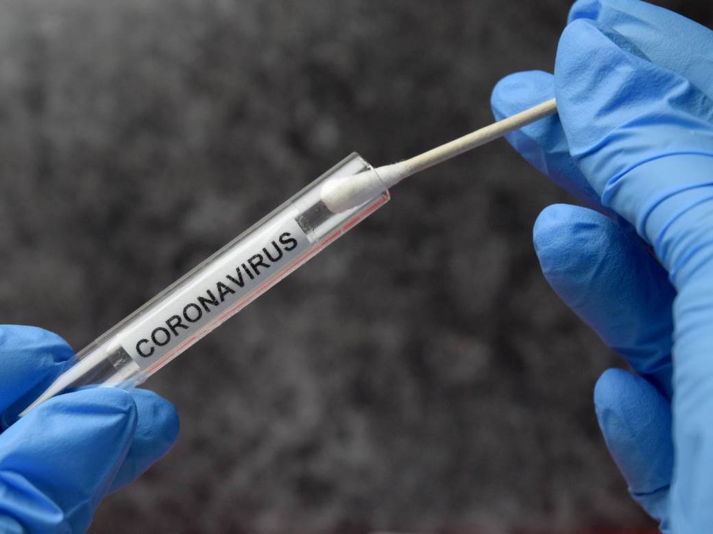  Analizirano 267, 22 pozitivno na novi koronavirus 