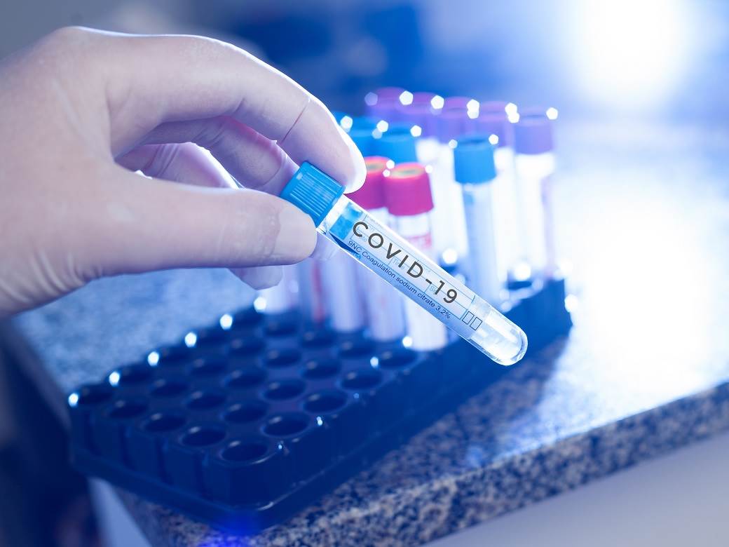  ISPRAVKA: Netačne tvrdnje u tekstu o PCR testiranju na korona virus 