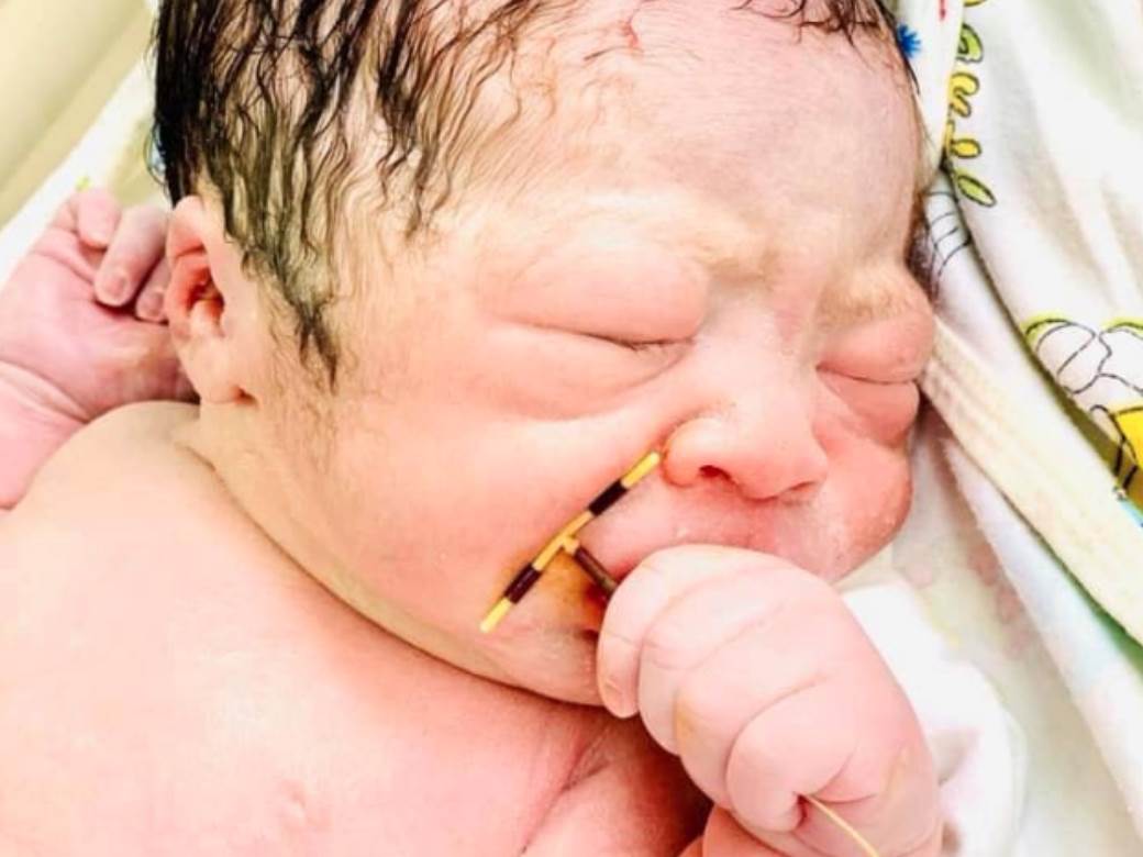  SLIKA KOJA JE OBIŠLA SVIJET: Vidite li šta novorođena beba drži u ruci? 