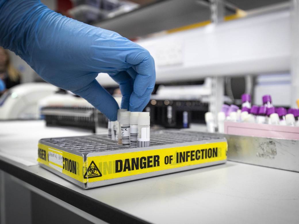  Interpol: Zaplenjeno 17.000 lažnih testova za korona virus! 