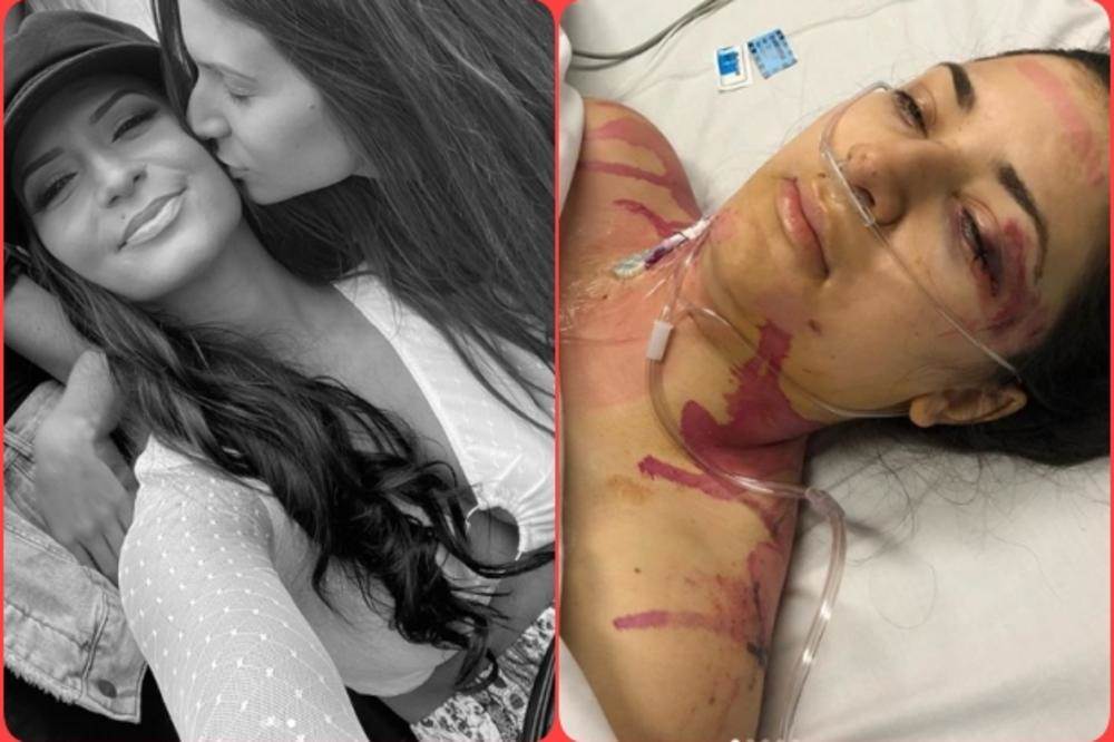  PALA SA MOTORA I SLOMILA KIČMU: Šokirala ljekare nakon 11 nedjelja (VIDEO) 