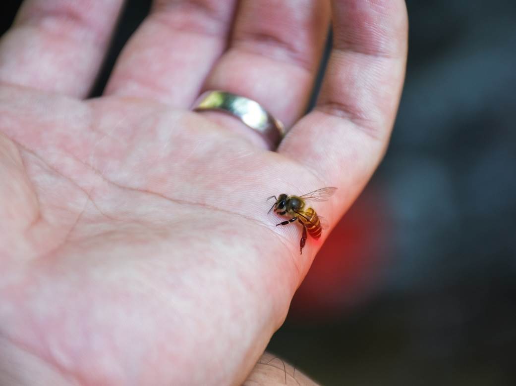  Alergija na UJED PČELE: Ovaj POGREŠAN POTEZ može dodatno da UGROZI ŽIVOT! 