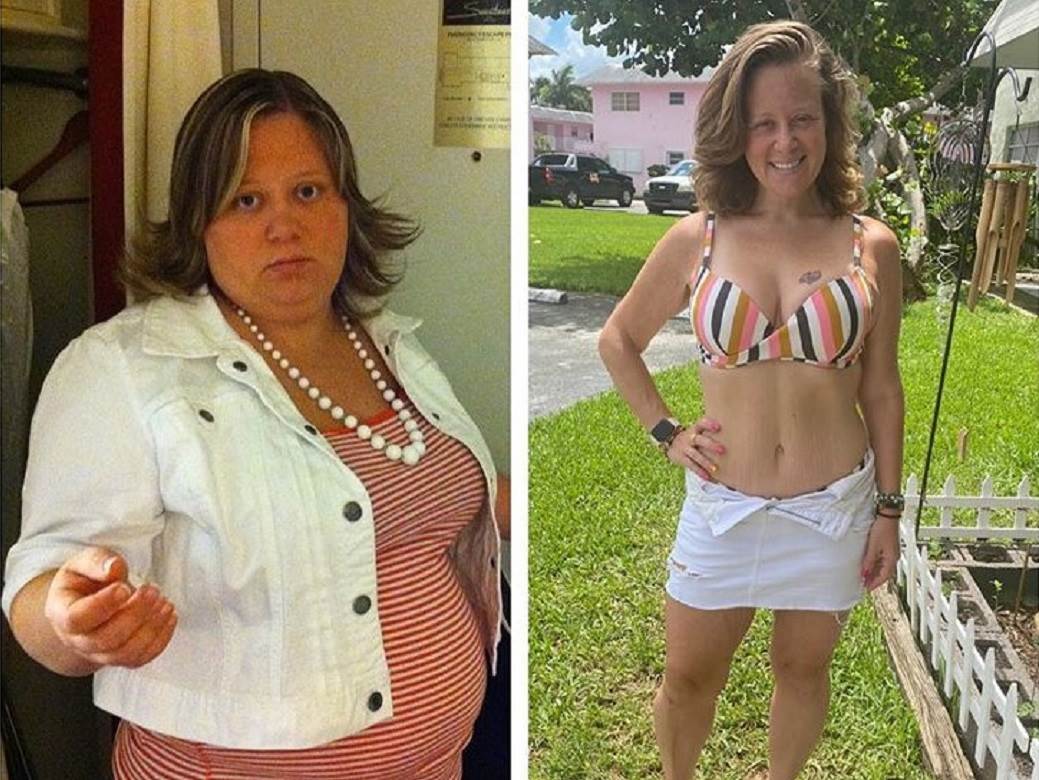  NEKAD SU JE ZVALI KIT: Smršala je 75 kilograma i sada je prava ribetina! Šokantna transformacija! 