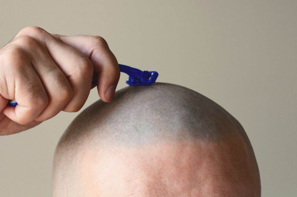  SLUČAJ KOJI JE ŠOKIRAO FRANCUSKU: Devojci obrijali glavu 