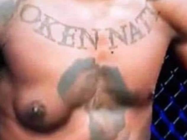   UFC šampion objasnio labavi prsni mišić koji je zapalio društvene mreže 