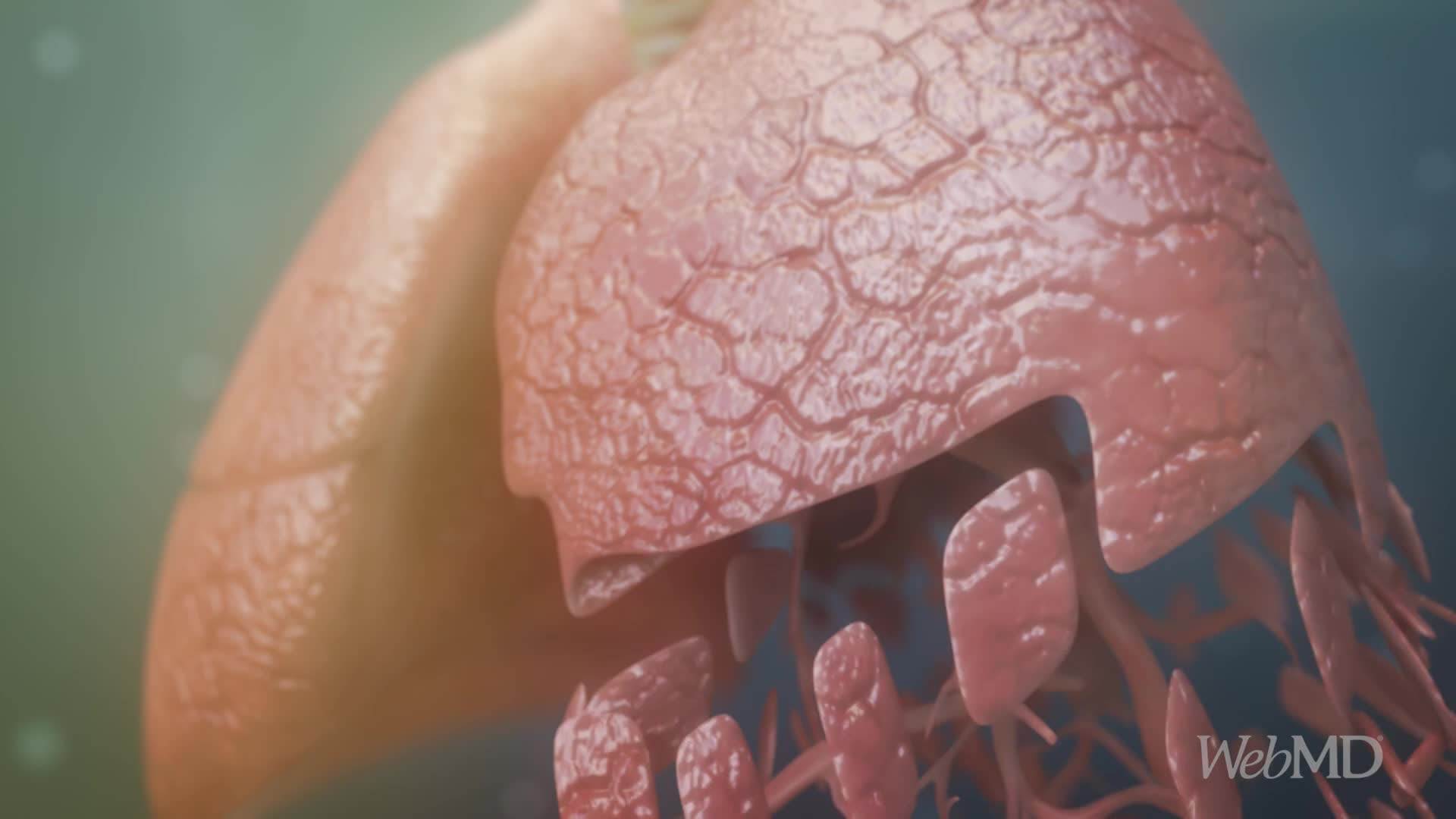  KAKO ZVUČE ZDRAVA, A KAKO PLUĆA POD UPALOM? Postoje 4 različite vrste disanja na koja treba da obratite pažnju VIDEO 