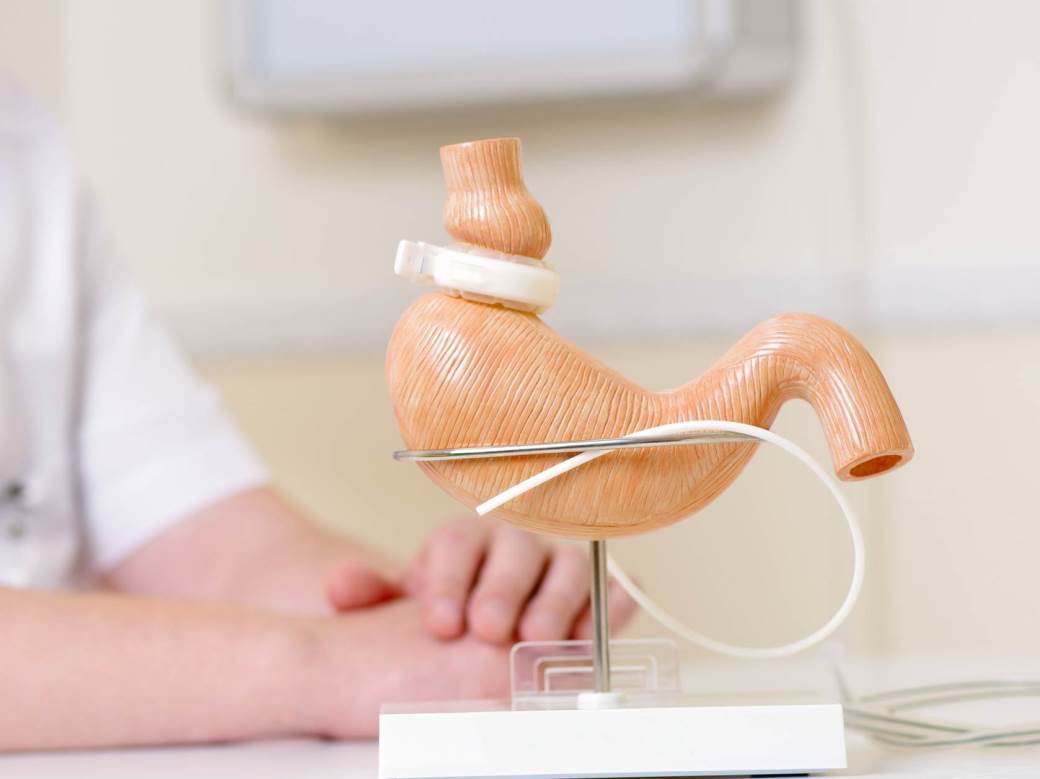  KAKO OPERACIJA SMANJENJA ŽELUCA POĐE PO ZLU 