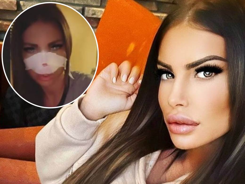  dragana mitar ponovo plastične operacije 