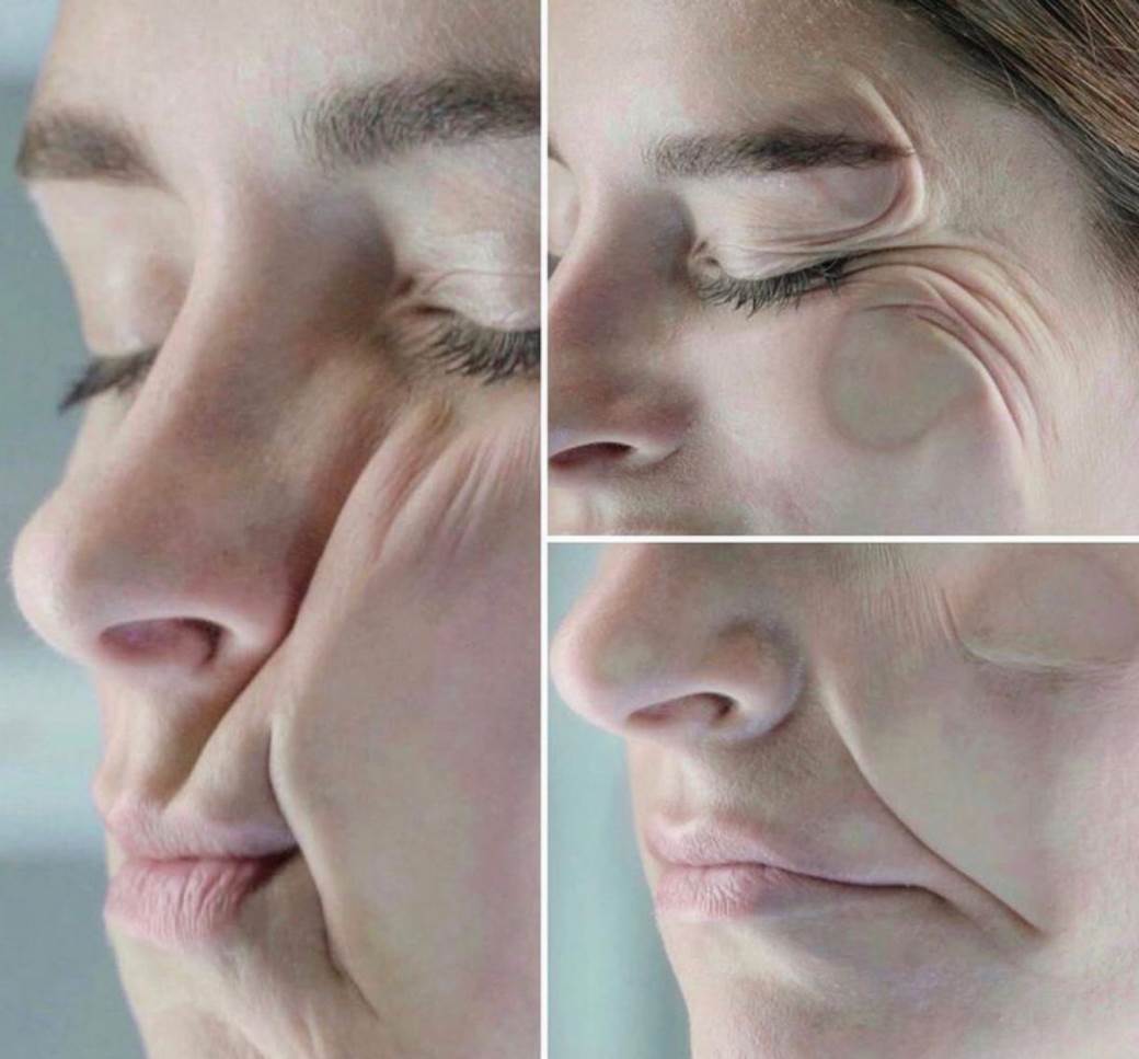  FOTKE KOJE SVI KOJI SPAVAJU NA BOKU TREBA DA VIDE: Pogledajte dobro šta radite svom licu 