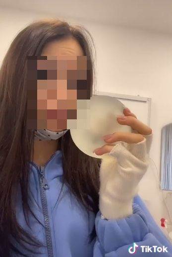  Pogrebnik otkrio da li se silikonin uklanjaju prije sahrane 