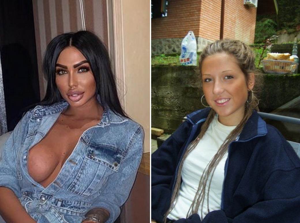   Tijana Ajfon objavila sliku PRE plastičnih operacija 
