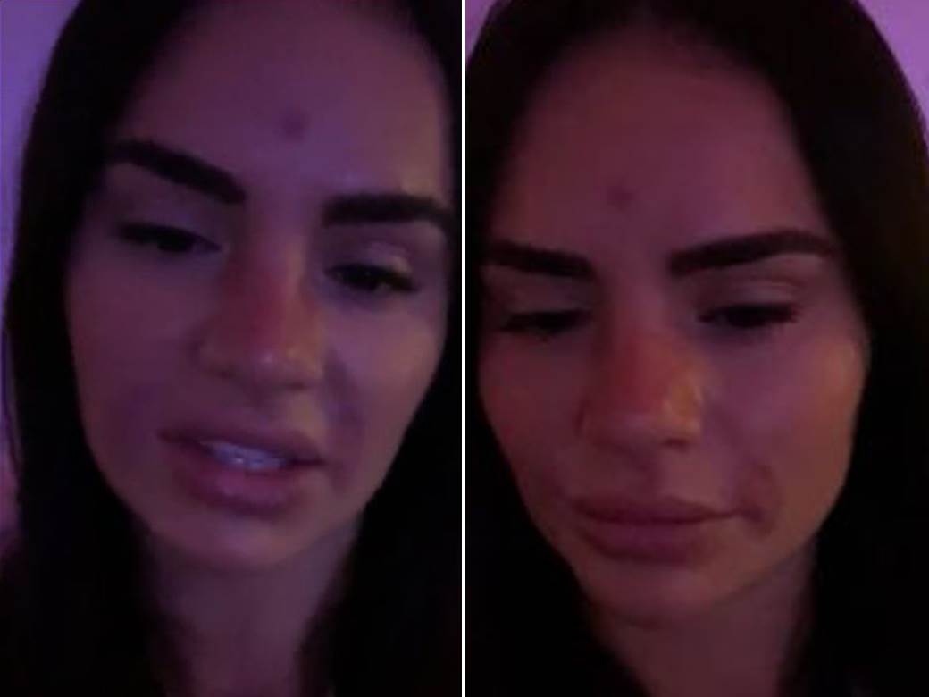  UŽIVO OTKRILA KAKO SU JOJ UNAKAZILI LICE U BG SALONU: Pomozite, šta da radim? Tužba svakako sledi! 
