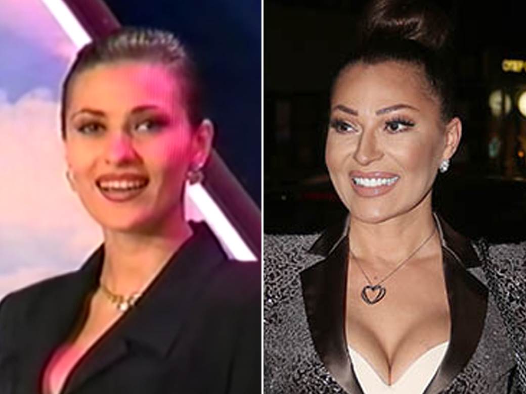  ceca raznatovic prije operacija 