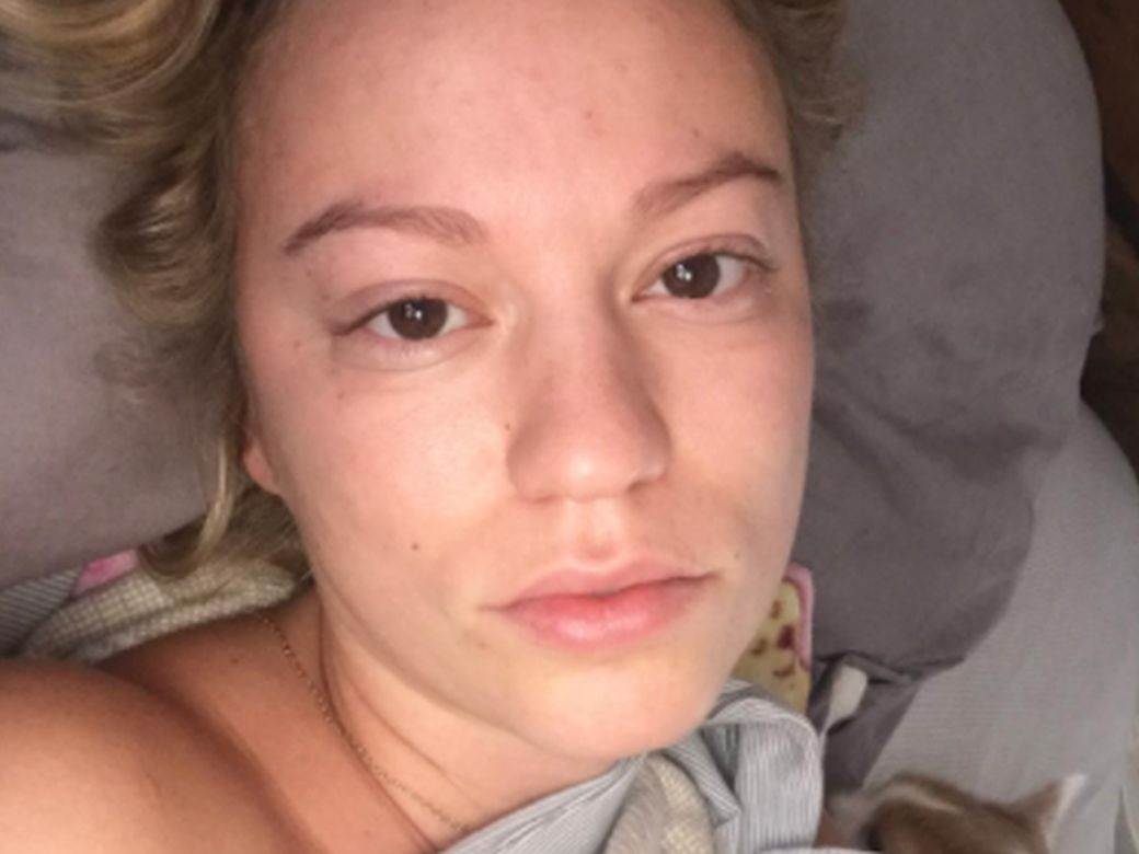  kako se riješiti podočnjaka 