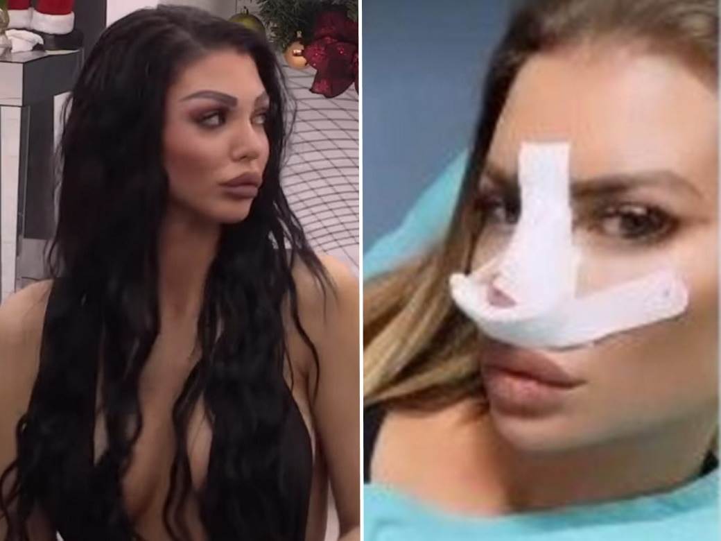  Dragana Mitar objavila koliko je do sada para dala na operacije 