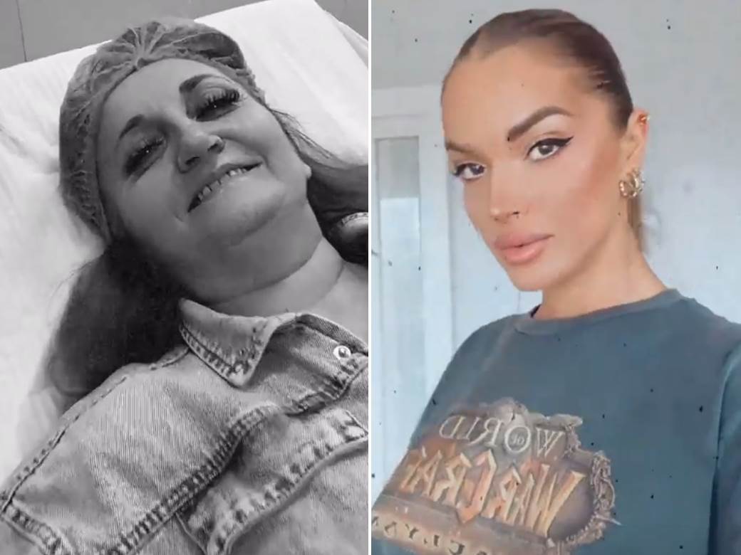  mama teodore dzehverovic na operaciji 