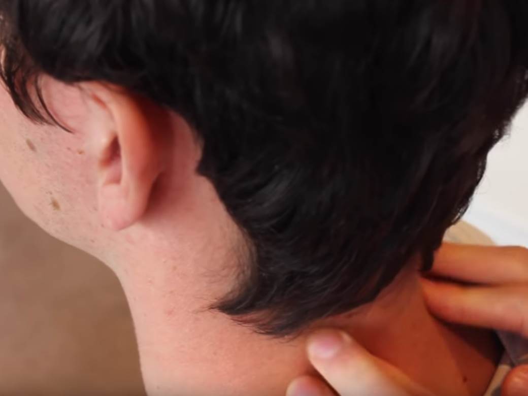  simptomi visokog holesterola 