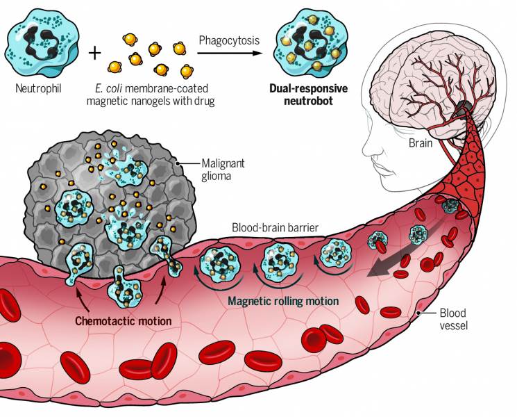  lecenje tumora robot 