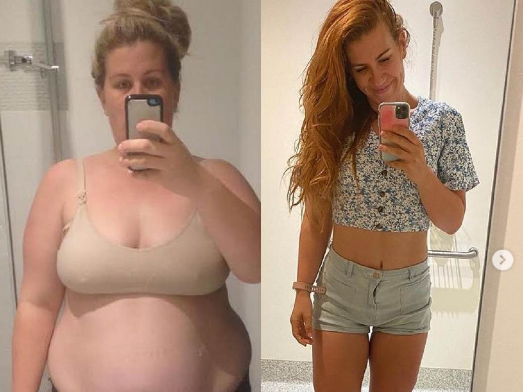  Medicinska sestra smrsala 50 kg 