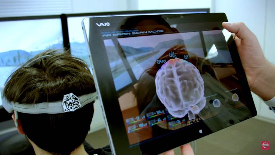  naucnici na pragu otkrica za paralizu 