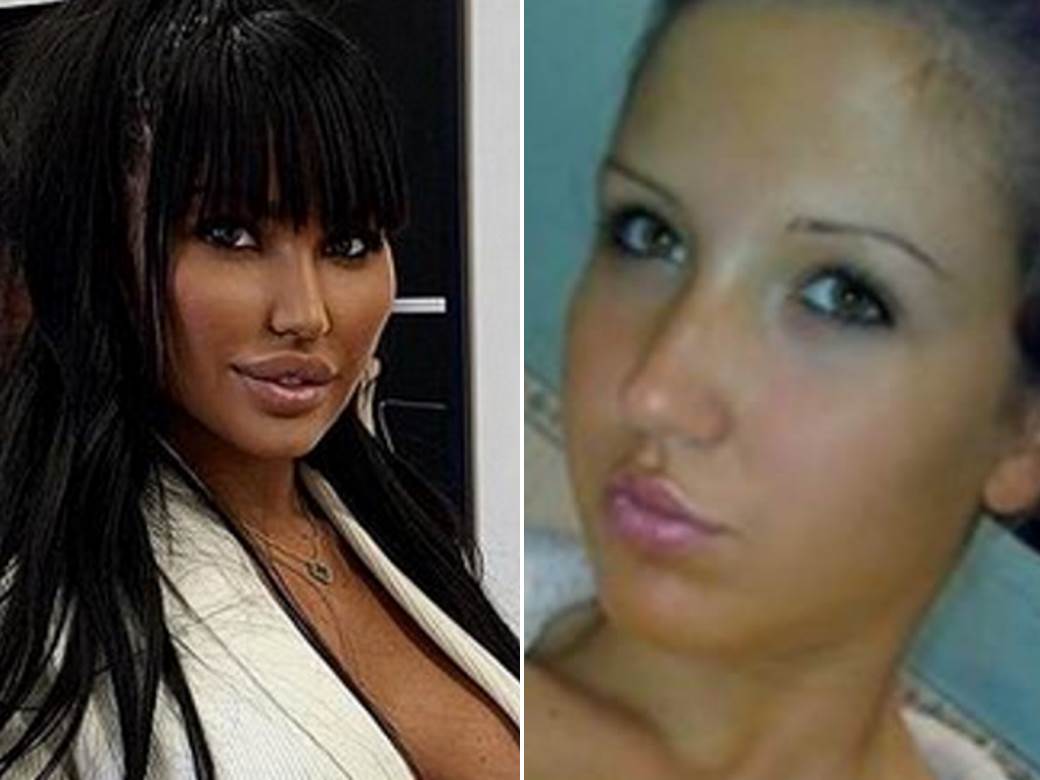  OPET IŠLA POD NOŽ?! Neverovatna transformacija Tijane Ajfon - starleta više ne liči na sebe 