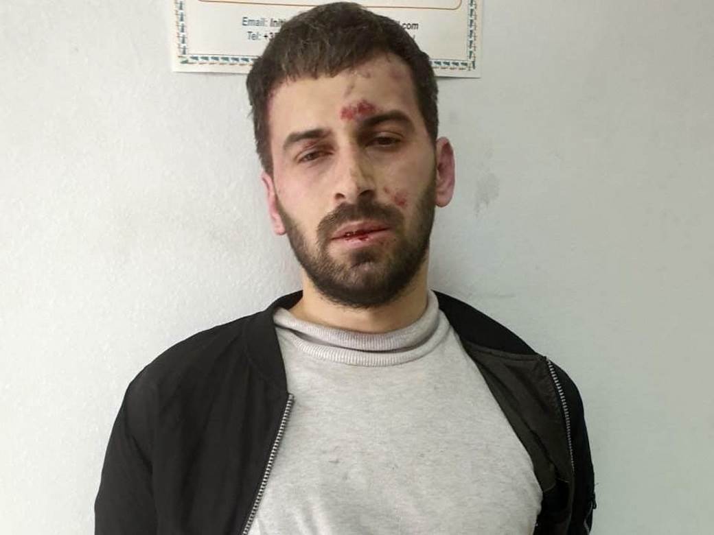  napad u dyamiji u albaniji video 