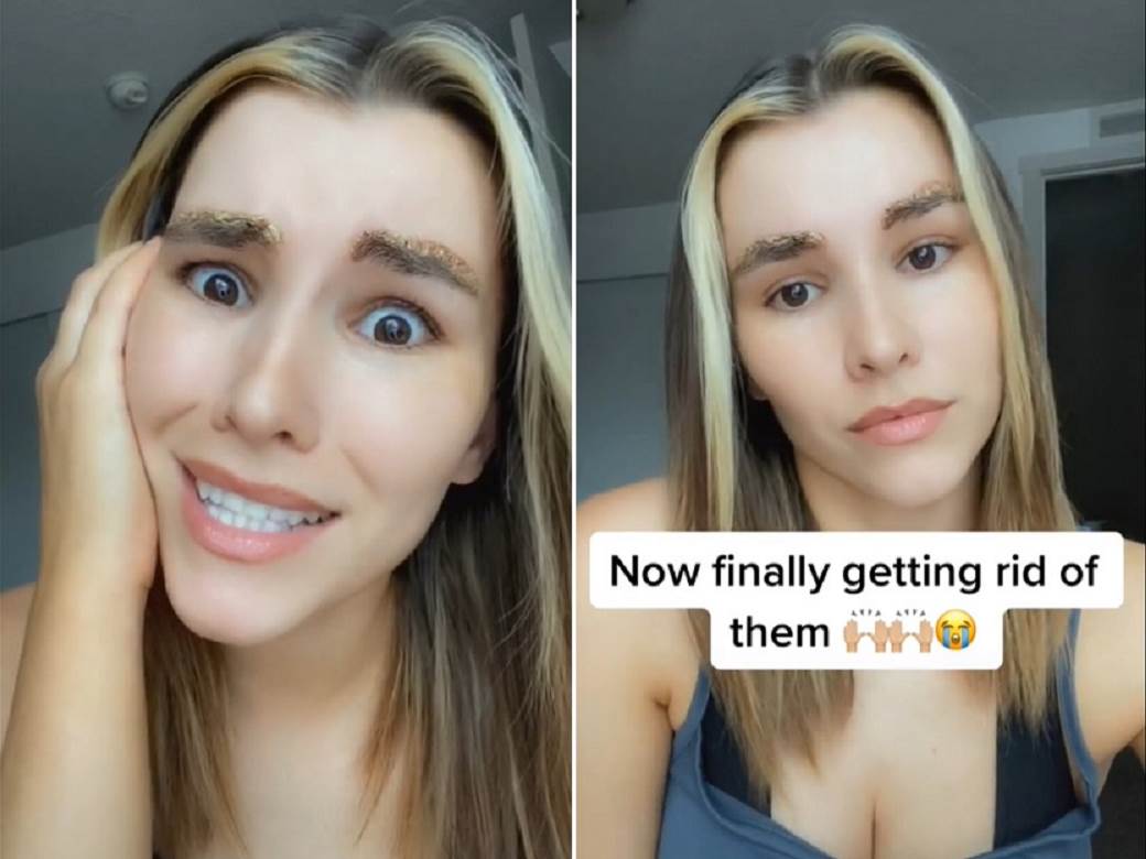  mikrobjelding obrva nezeljeni efekti 