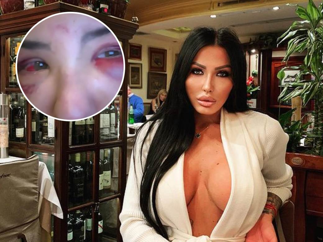  prebijena sara plavsic drugarica tijane ajfon  