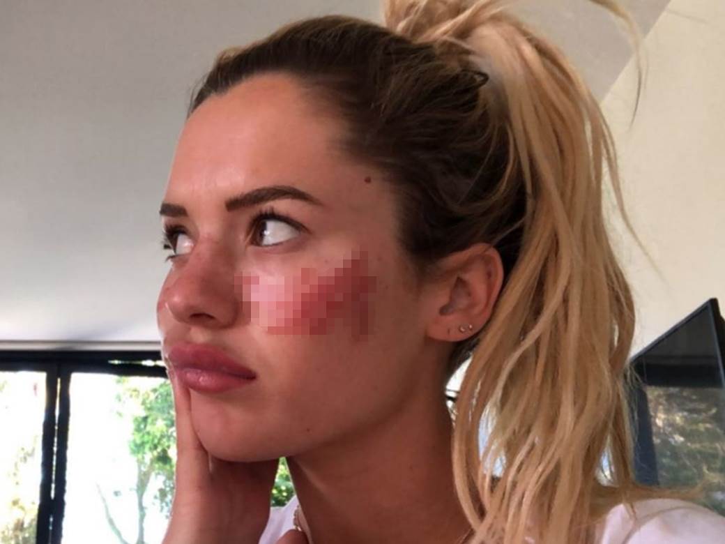  unakazeno lice ucesnice velikog brata 