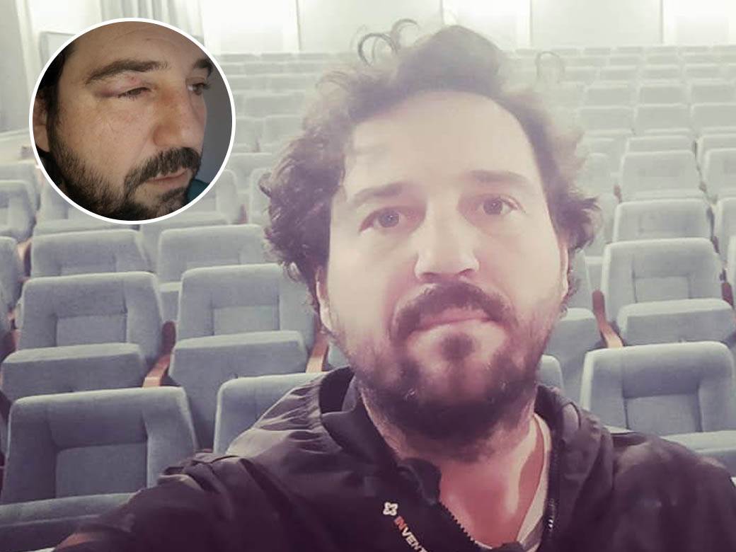  igra sudbine pretucen glumac 