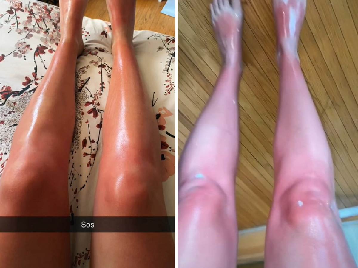  ne radite piling prije suncanja 