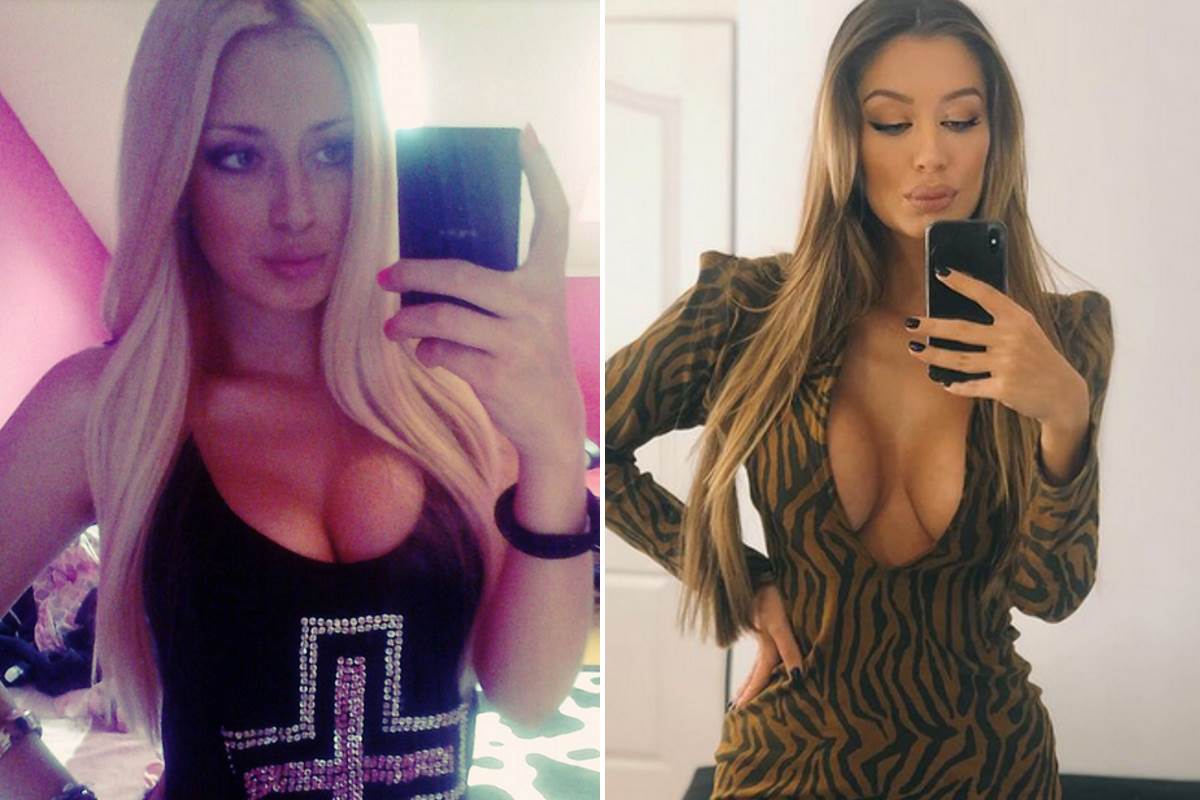  tea tairovic prije i posle operacija 