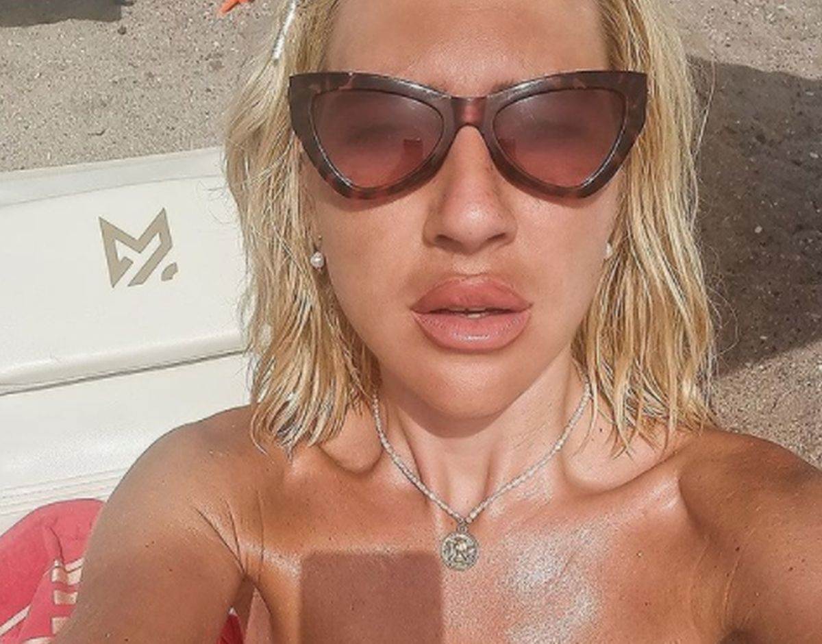  jovana jeremic estetske korekcije 