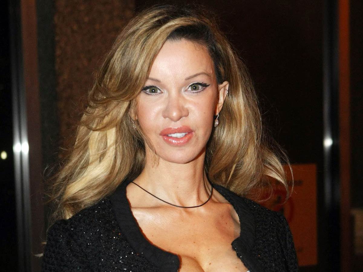  manekenka plasticne operacije 