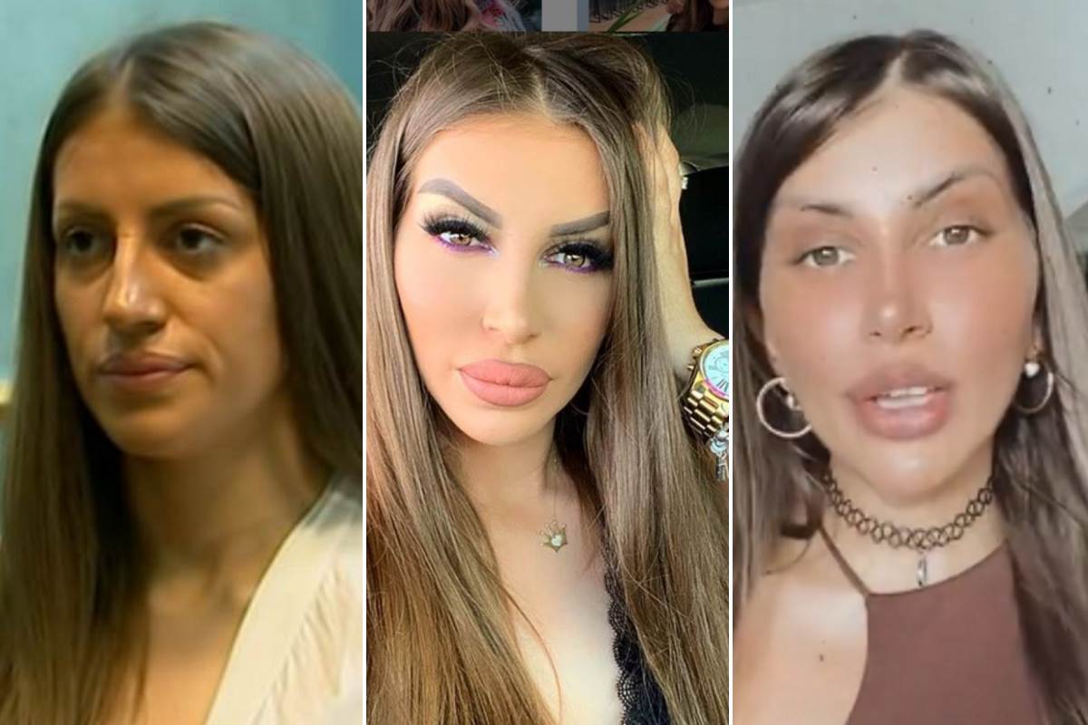  dalila dragojevic nekad i sad nakon operacija 