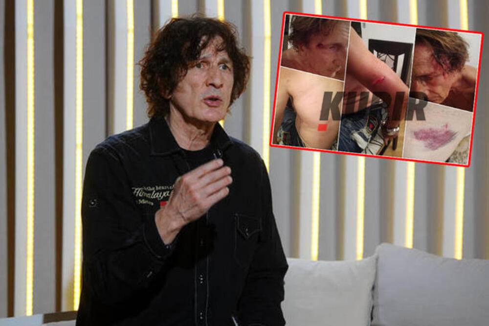  ranjen nebojska tubiv zabac 