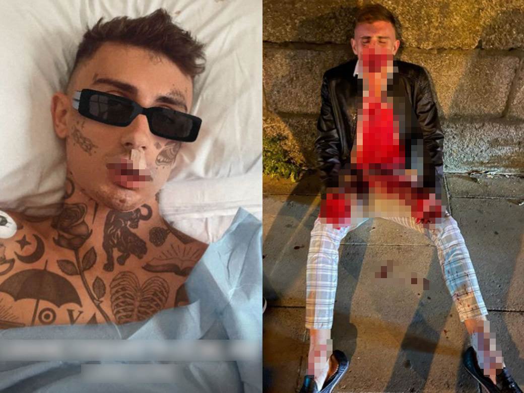  dzek vuli napadnut na setalistu 