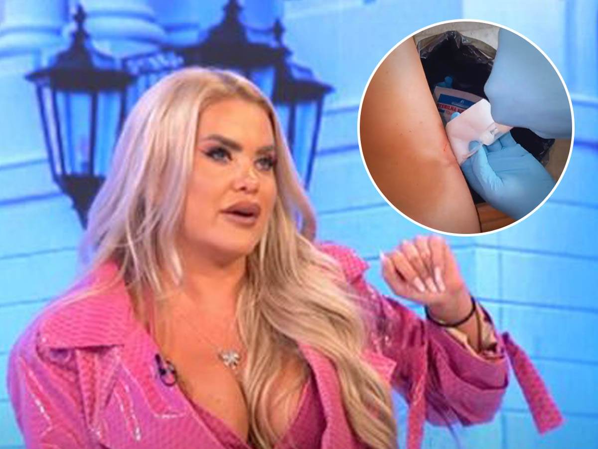  sanja stankovic zadobila povrede na bazenu 