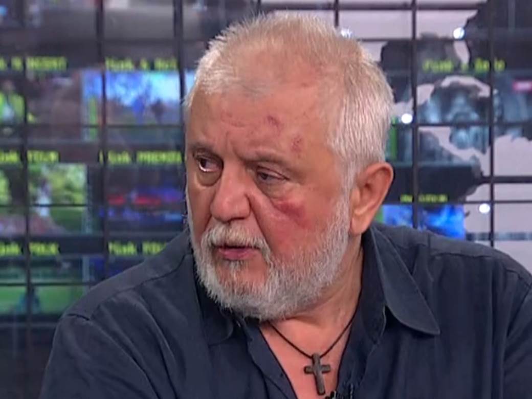  gaga antonijevic modrice nakon tuce sa bjelogrlicem  