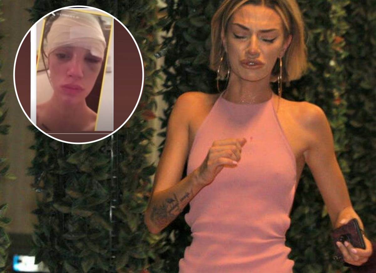  stravicne slike pretucene tare simov 